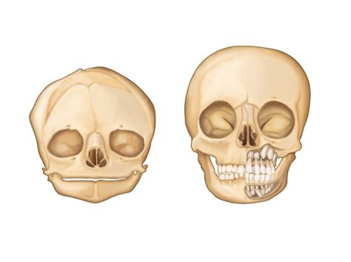 Are babies born with all their teeth in their skull?