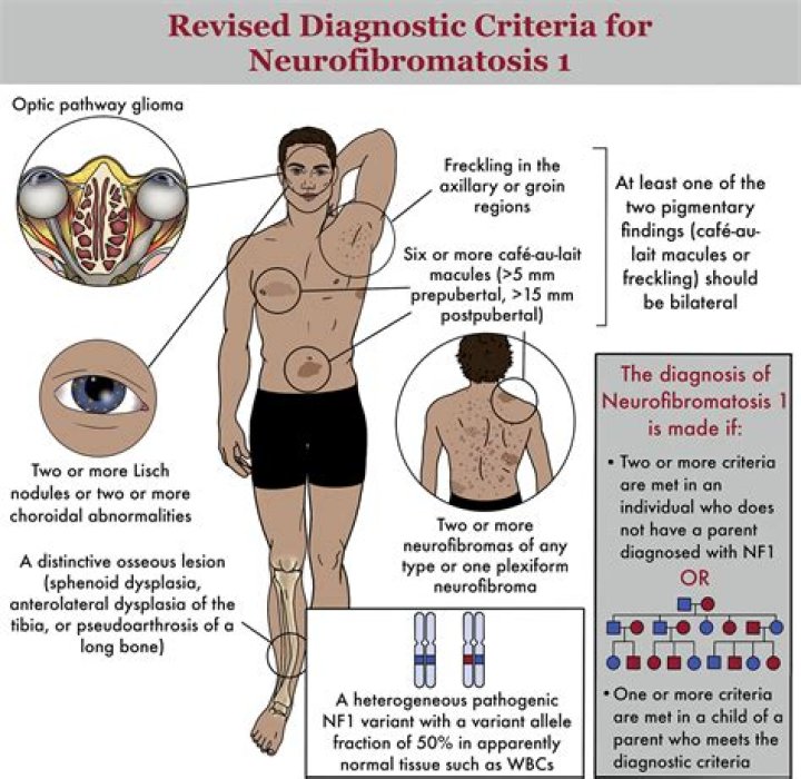 Are fibromas hard or soft?