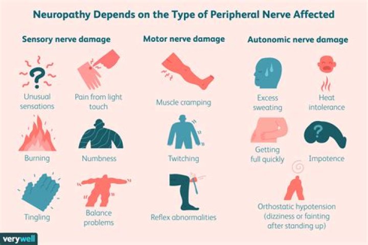Are nerve strikes real?