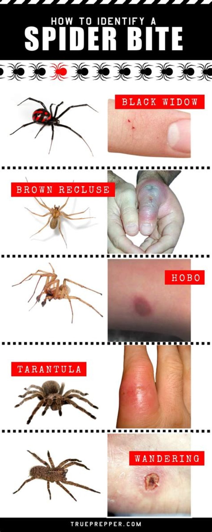 Are poisonous spider bites painful?