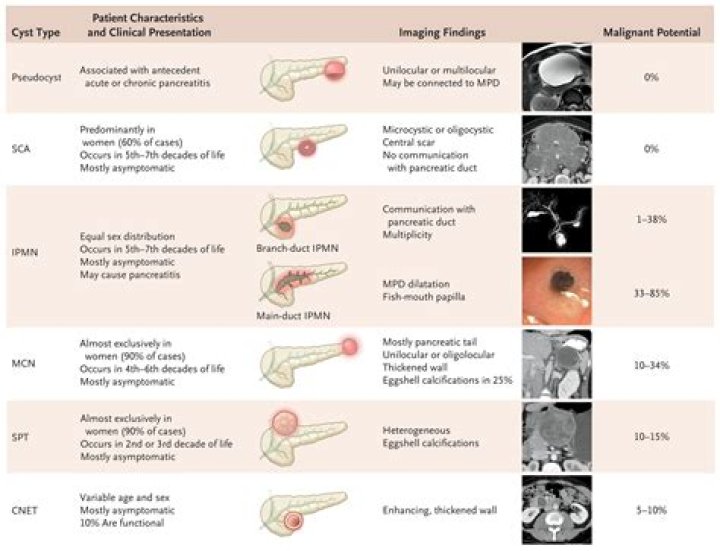 Are there different levels of cystic fibrosis?
