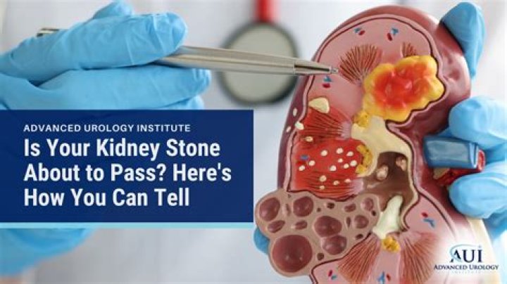 Can a kidney stone get stuck in your pee hole?