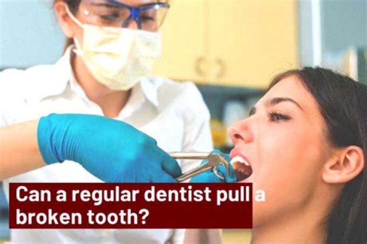 Can a regular dentist pull a broken tooth?