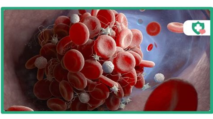 Can alfalfa cause blood clots?