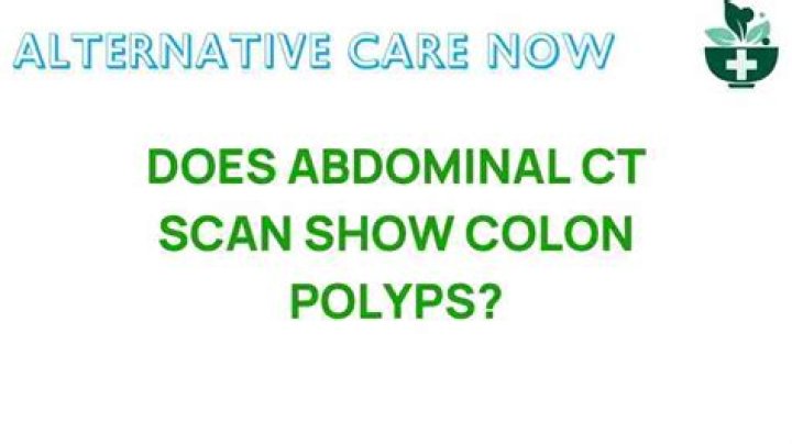 Can an abdominal CT scan detect colon polyps?