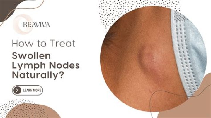 Can blood test detect swollen lymph nodes?