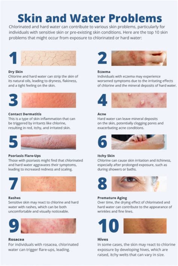 Can chlorine make you lightheaded?