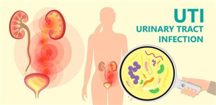 Can cloves cure urinary tract infection?