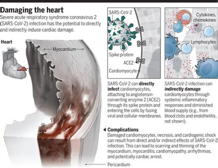 Can COVID affect the heart?