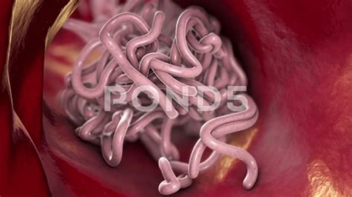 Can fruit worms live in your stomach?