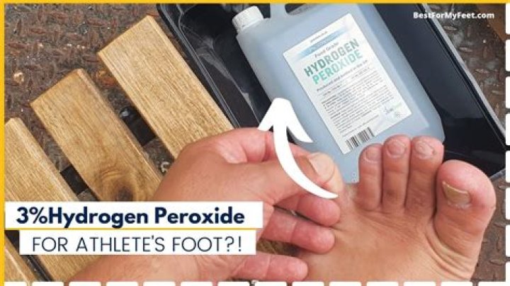 Can hydrogen peroxide help with eczema?