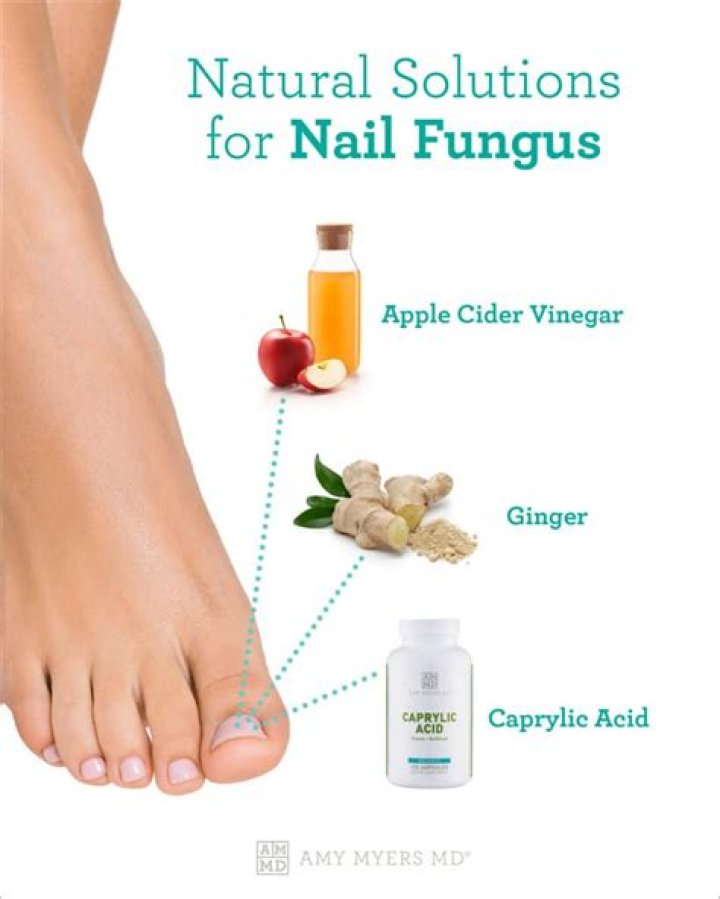 Can I apply apple cider vinegar directly to toenail fungus?