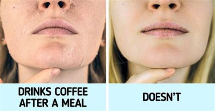 Can I drink coffee after a lip lift?