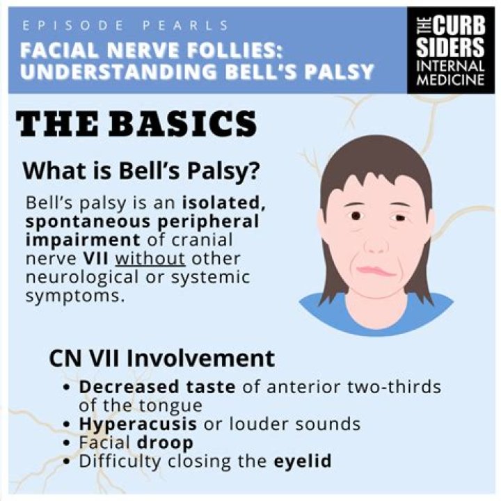 Can I drive with Bell's palsy?