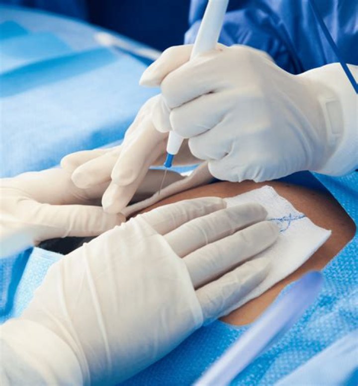 Can I sleep on my back after C-section?