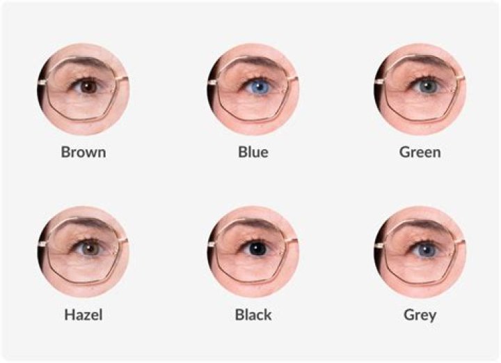 Can I train my eyes to not need glasses?