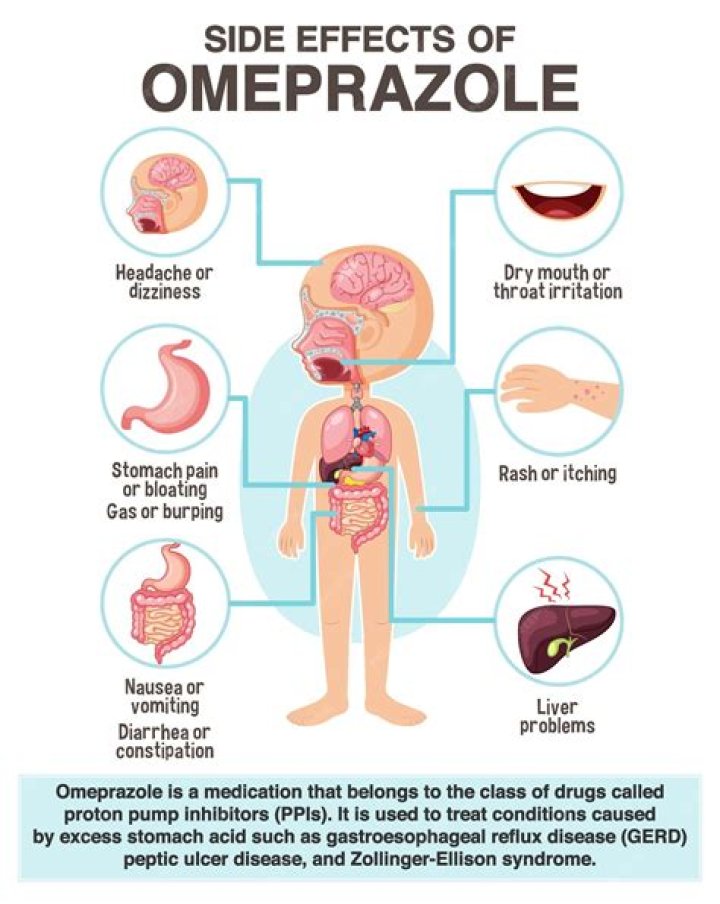 Can omeprazole cause polyps?