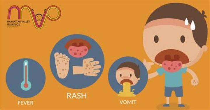 Can siblings go to school if one has hand foot and mouth?