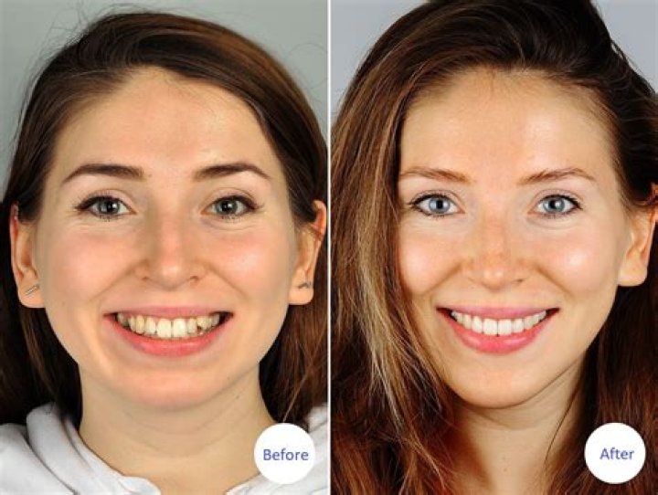 Can smiling change your face?