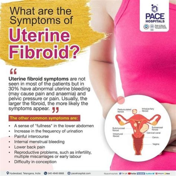 Can stress cause uterine fibroids to bleed?
