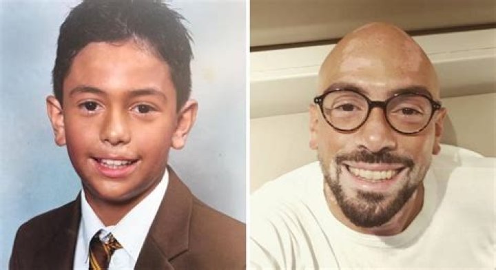 Can you fake tan over vitiligo?