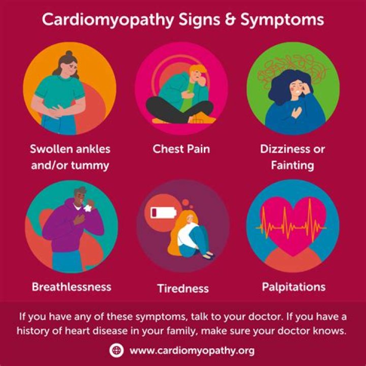Can you have a general Anaesthetic with cardiomyopathy?