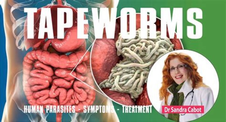 Can you see a tapeworm in your stool?