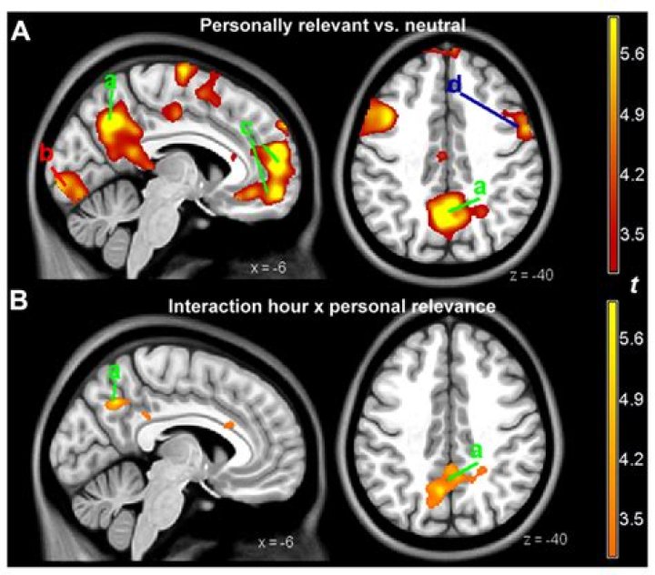 Can you see narcissism in a brain scan?