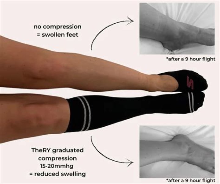 Can you sleep with a compression sleeve on your leg?