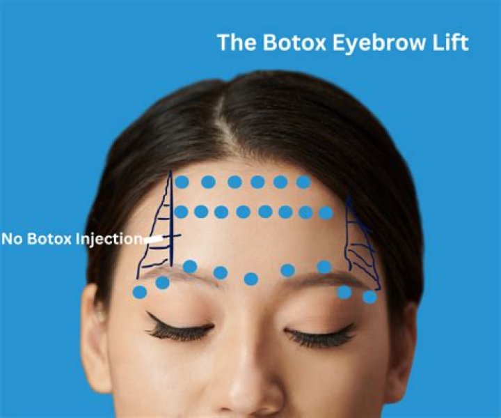 Can you still move your eyebrows with Botox?