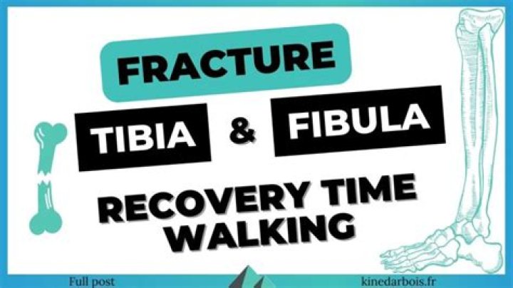 Can you walk on a fractured fibula?