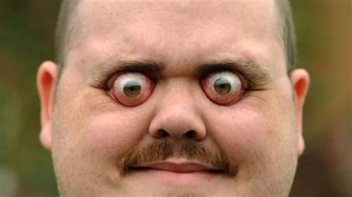 Can your eyeballs fall out?