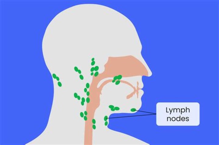 Can your lymph nodes swell without infection?