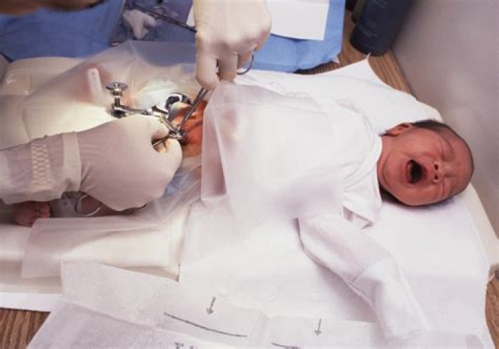Do babies feel circumcision?