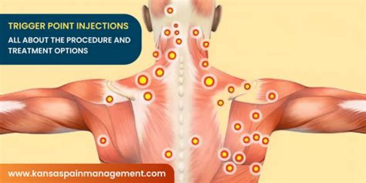 Do chiropractors give trigger point injections?