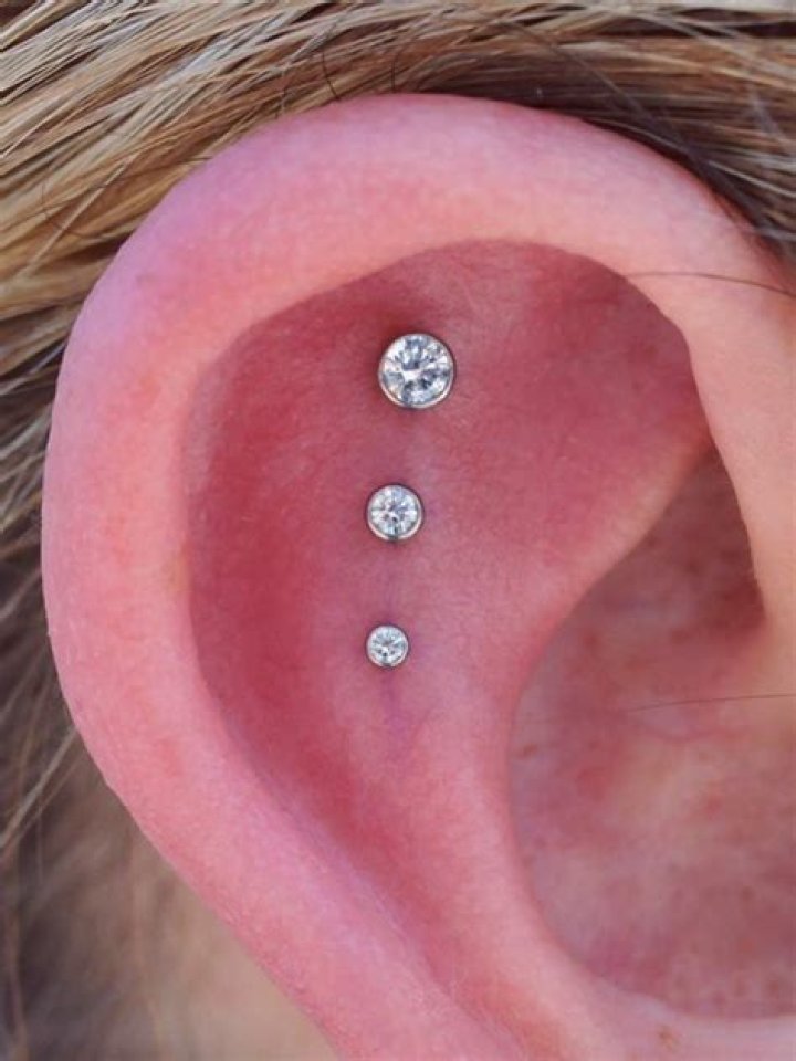 Do ear piercings close up after years?