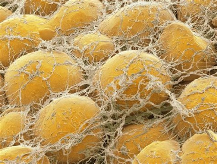 Do fat cells go away?