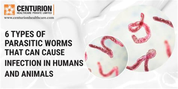 Do human naturally have worms?