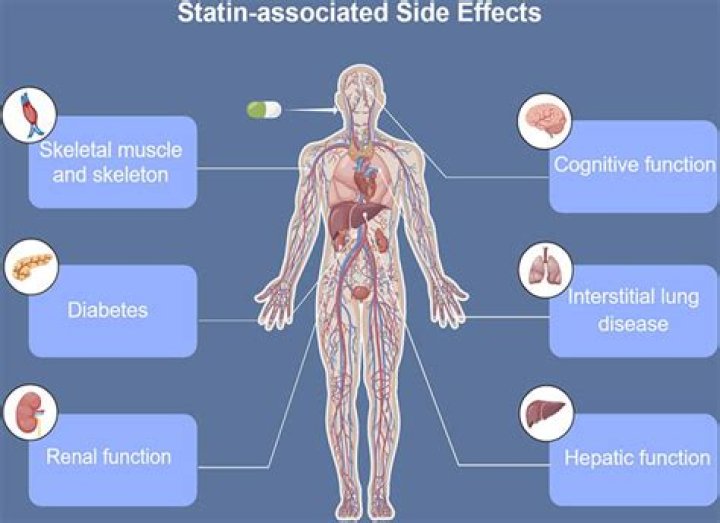 Do statins affect your legs?
