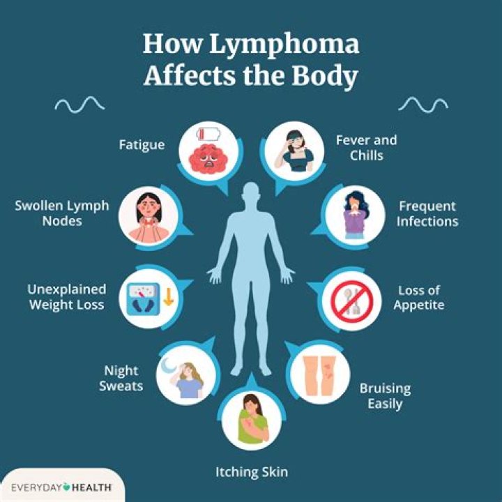 Do you lose weight with lymphoma?
