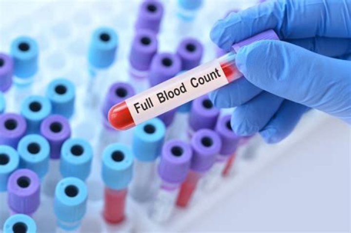 Does a full blood count show thyroid problems?