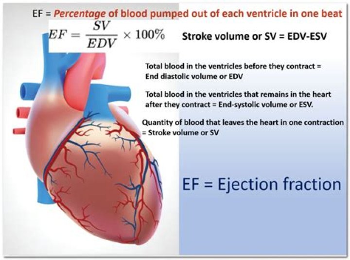 Does an ICD help with ejection fraction?