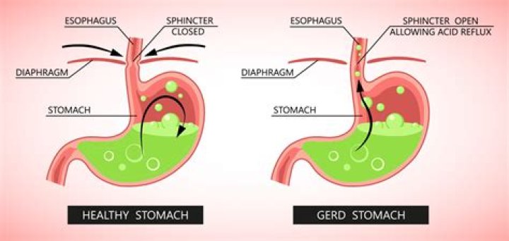 Does c-section damage stomach muscles?