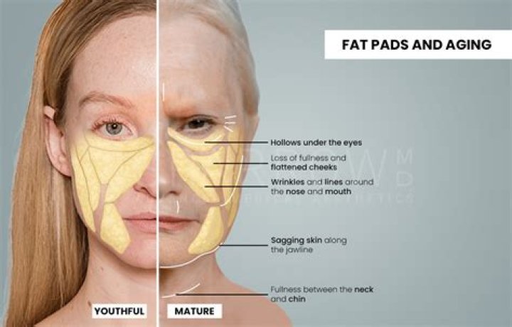 Does drinking make your face fat?