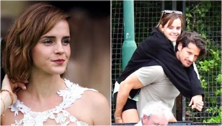 Does Emma Watson have natural freckles?