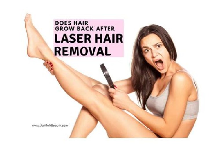 Does hair grow back after laser?