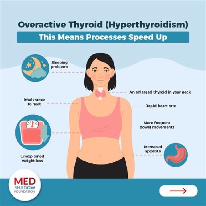 Does hypothyroidism get worse over time?