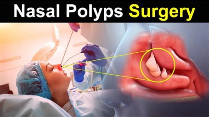 Does it hurt after polyps are removed?
