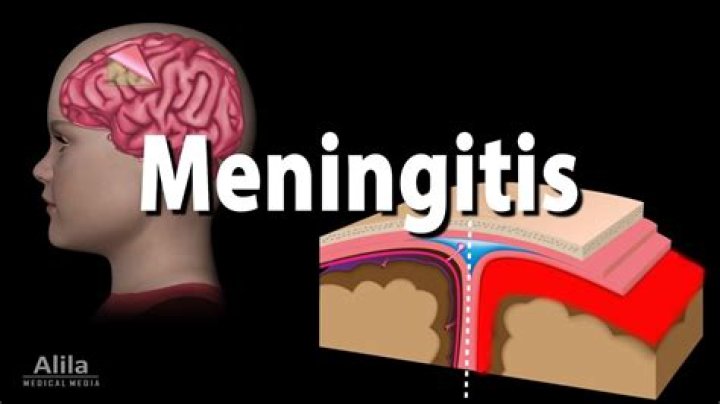Does meningitis show up in blood work?