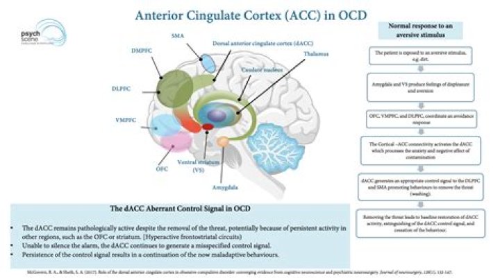 Does OCD count as a learning disability?